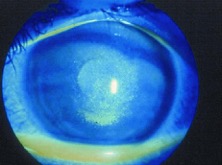 figure3